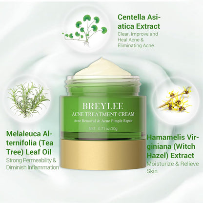 BREYLEE Crema per il trattamento dell'acne, Crema per l'acne all'olio dell'albero del tè per eliminare l'acne grave, gli sfoghi cutanei, rimuovere i brufoli e riparare la pelle (20 ml, 0,7 once)