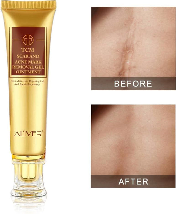 Scar Removal Cream - TCM Scar Cream for Surgical Scars, Acne Skin Care Cream, Acne Treatment Cream for Scars, Burns, Stretch Marks, Acne Spots - Sccoti
