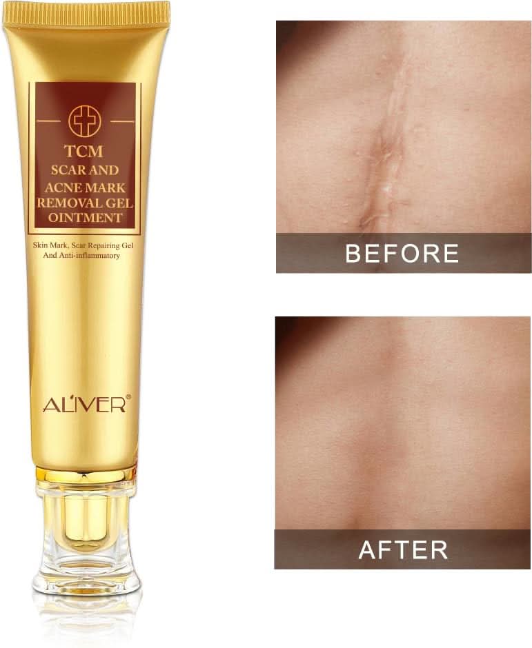 Scar Removal Cream - TCM Scar Cream for Surgical Scars, Acne Skin Care Cream, Acne Treatment Cream for Scars, Burns, Stretch Marks, Acne Spots - Sccoti