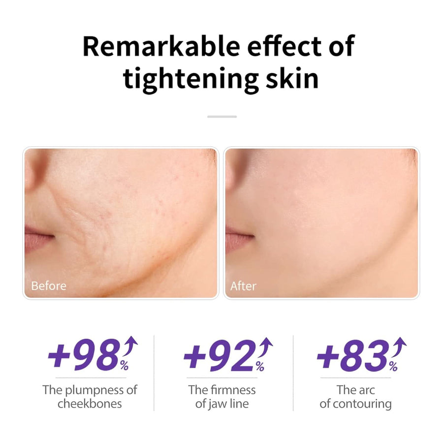 LANBENA Retinol Serum for Face, Retinol Serum with Hyaluronic Acid for Wrinkles and Fine Lines, Renew and Plump Night Facial Serum for Glowing Skin, Serum for Sensitive Skin, 30ml - Sccoti