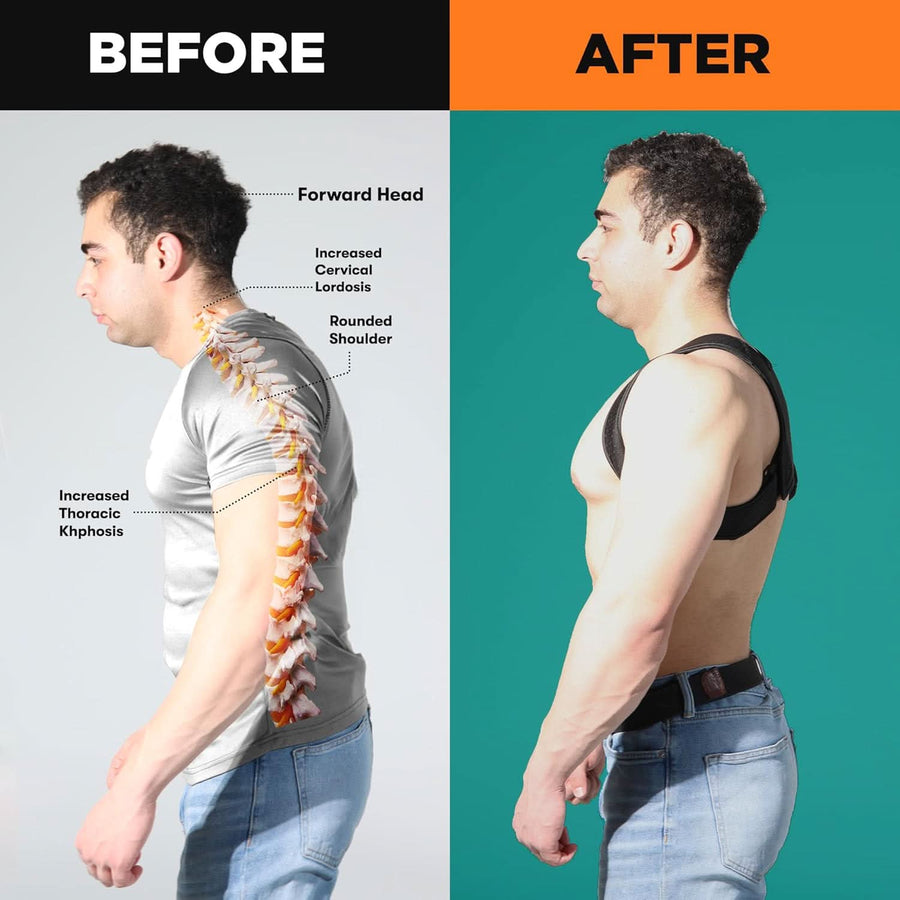 Posture Corrector & Spine Support | Universal Fit Adjustable Upper Back Brace For Clavicle To Support Neck, Back and Shoulder Pain Relief Kyphosis Straightener - Sccoti