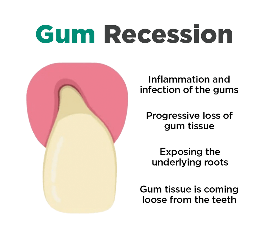 JaySuing™ Teeth Whitening Pen - Sccoti
