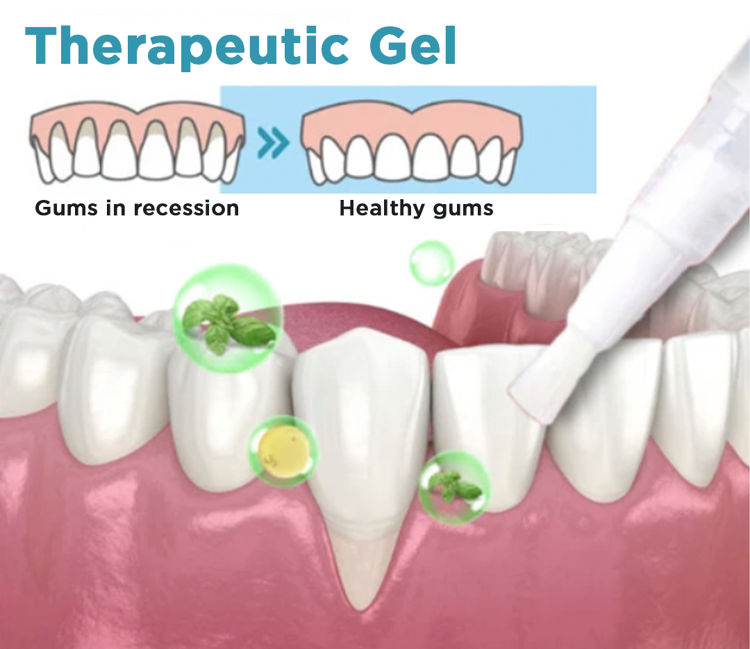 Gel terapêutico JaySuing™ para acalmar gengivas