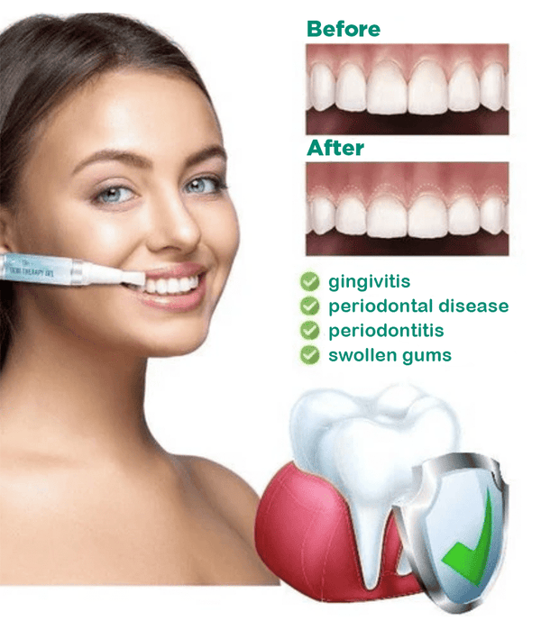 JaySuing™ Therapeutic Gel for Gum Relief - Sccoti