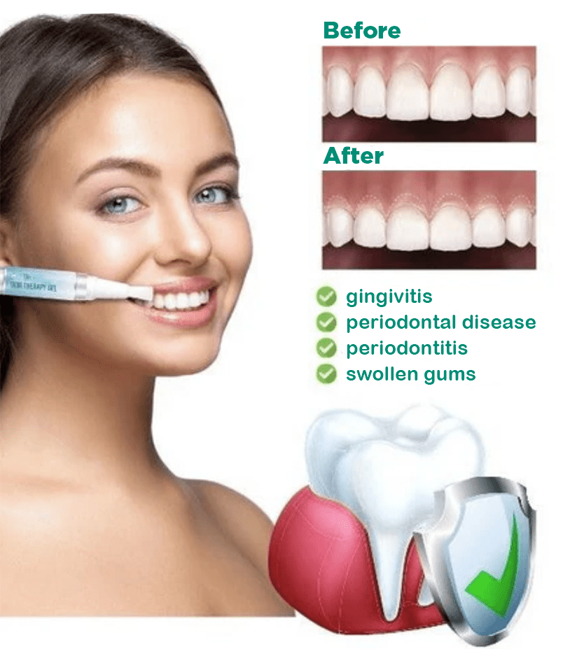 JaySuing™ Therapeutic Gel for Gum Relief - Sccoti