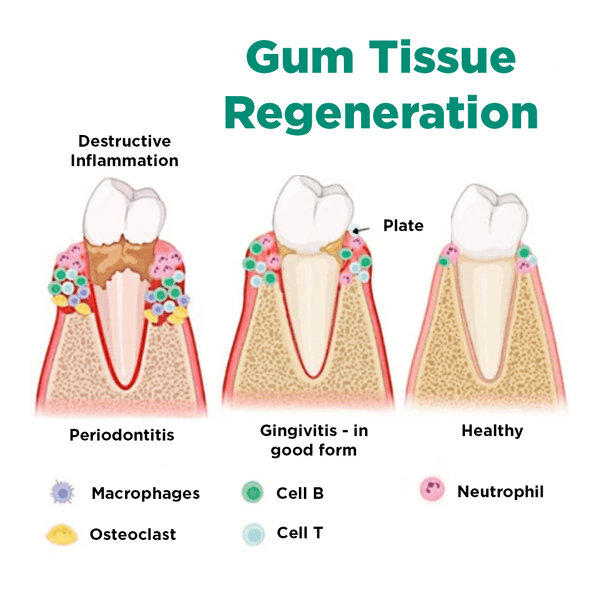 JaySuing™ Therapeutic Gel for Gum Relief - Sccoti