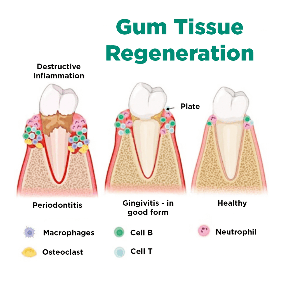 JaySuing™ Therapeutic Gel for Gum Relief - Sccoti