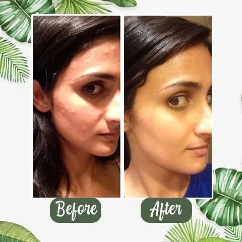 Natural Organic Avocado Deep Cleansing Bubble Mask - Sccoti